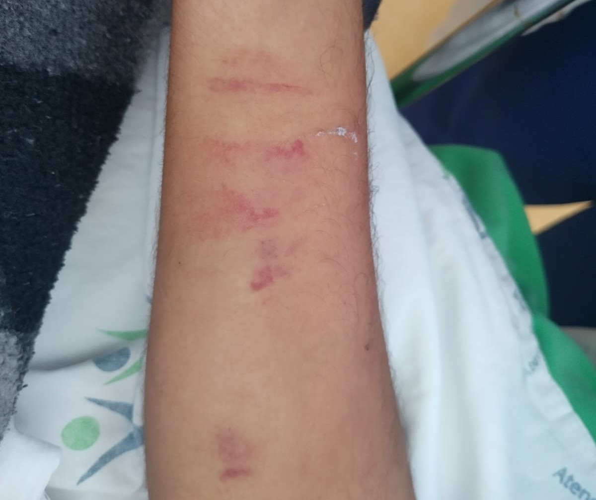 De acordo com informações repassadas pela mãe do paciente, o jovem está internado desde o dia 9 de junho após ter sido atropelado