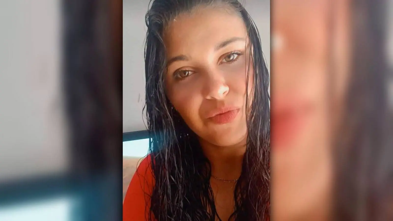 Homem que matou a companheira em Pontal do Paraná é condenado a 35 anos de prisão; ele jogou gasolina no corpo da vítima 1 FOTO01 - Com queimaduras nos braços, rosto, costas e tórax, Amanda foi transferida do Hospital Regional do Litoral para o Hospital Universitário Evangélico Mackenzie, em Curitiba, onde faleceu no dia 9 de outubro - Foto: Redes Sociais